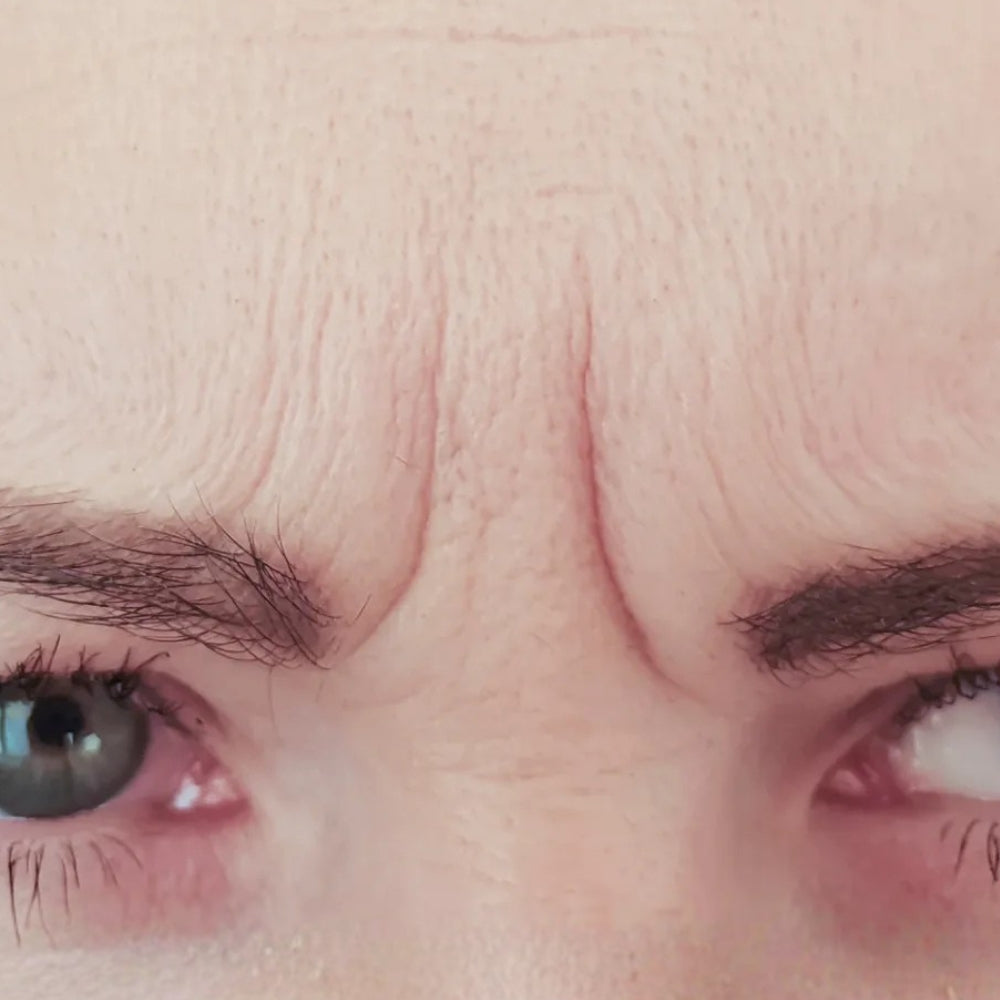 Frown lines (11s)