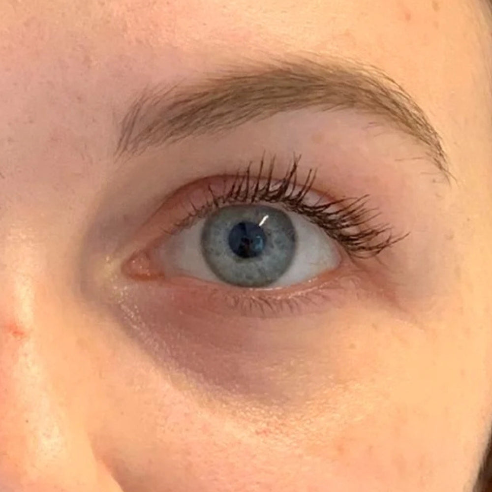 Under eyes