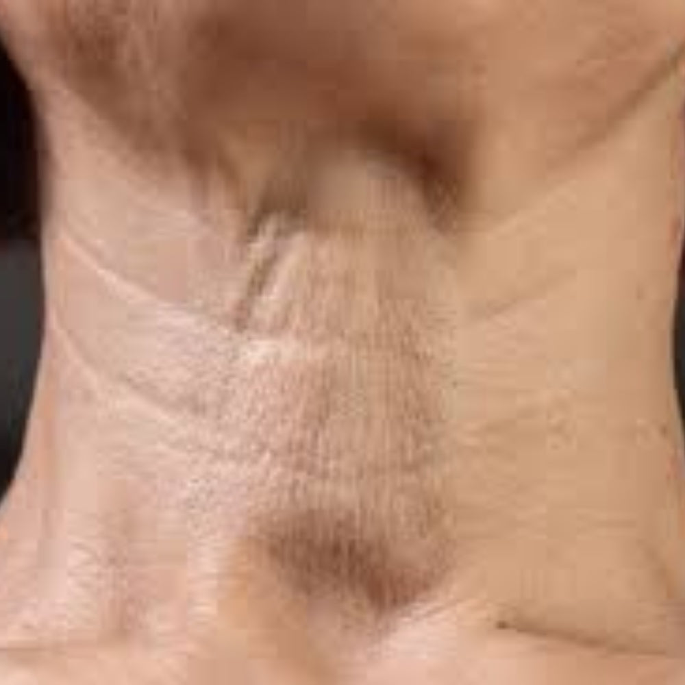 Neck