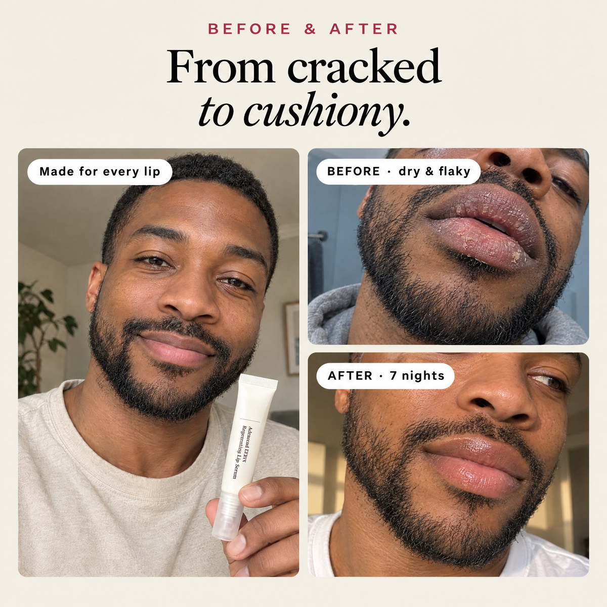 Before and after: dry, flaky lips and smooth, glossy lips after 7 nights of kin PDRN Lip Serum
