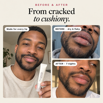 Before and after: dry, flaky lips and smooth, glossy lips after 7 nights of kin PDRN Lip Serum